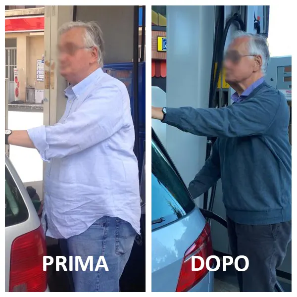 Dimagrimento Addome Pancia Dottoressa Milena Massari